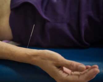 Acupuncteur Marion Bearez 