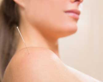 Prise de rendez-vous Acupuncteur Muraccioli Marie-france