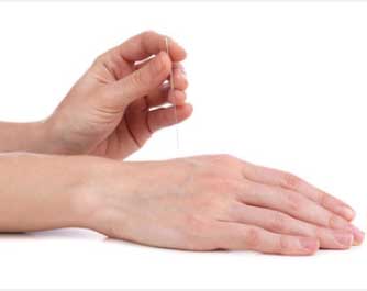 Prise de rendez-vous Acupuncteur Eurostéo