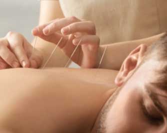 Acupuncteur Christian Cheveau 