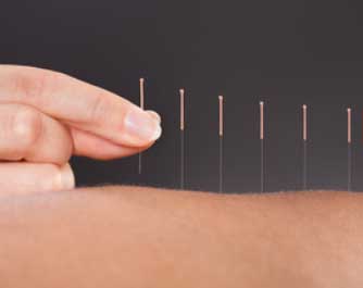 Acupuncteur Anne Macé 