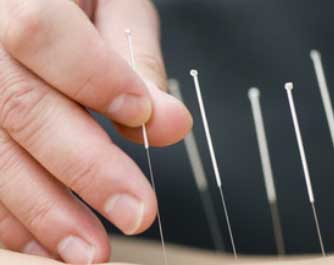 Acupuncteur Le Roch Thierry 