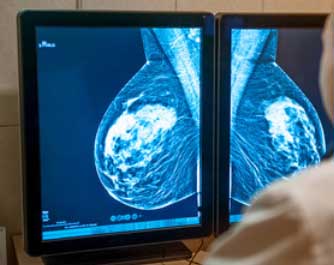 Prise de rendez-vous Cardiologue ACMS