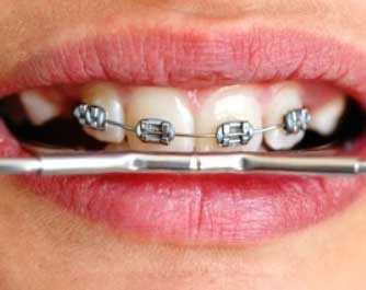 rendez-vous avec le docteur Chirurgien Dentiste Orthodontie Docteur Brossier