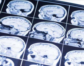 rendez-vous avec le docteur Chenesseau Bertrand